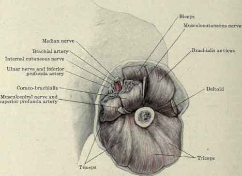 Fig. 288.   Amputation just above the middle of the arm.