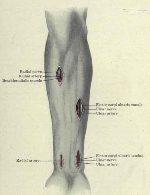 Fig. 330.   Ligation of the radial and ulnar arteries.