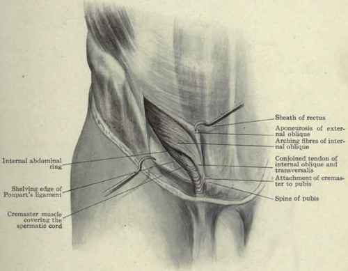 Fig. 396.   Parts concerned in inguinal hernia; the inguinal canal exposed.