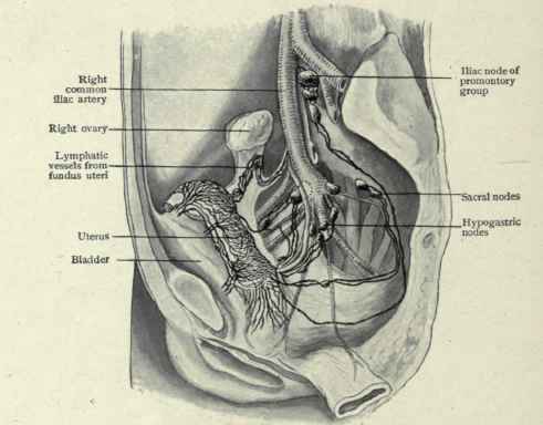 Fig. 461.   Lymphatics of uterus. (Cuneo and Marcille).
