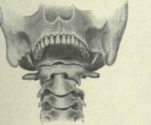 Fig. 483.   Anterior view, showing relation of transverse process of atlas to tip of mastoid process.