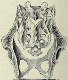Fig. 492.   The ischiosacral arch. The main arch passes upward from one tuberosity of the ischium through the sacrum down to the opposite tuberosity; the subsidiary arch passes forward from one tuberosity of the ischium through the pubes and back to the opposite tuberosity.