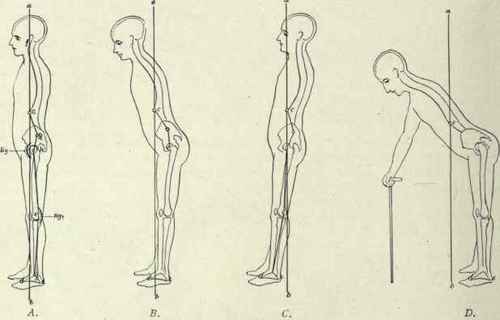 Fig. 494.   Anteroposterior equilibrium.
