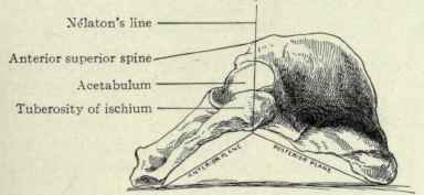 Fig. 502. Innominate bone, resting on its inner side, to show the wedge shaped formation of its outer sur. face. The apex of the wedge is Nelaton's line, running from the anterior superior spine to the tuberosity of the ischium; the anterior plane inclines downward and forward toward the pubis and the posterior plane inclines downward and backward on the ilium.