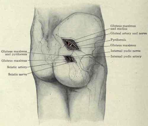 Fig. 508.   Ligation of the gluteal, internal pudic, and sciatic arteries.