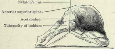 Fig. 512.   Innominate bone, resting on its inner side, to show the wedge shaped formation of its outer surface. The apex of the wedge is Nelaton's line, running from the anterior superior spine to the tuberosity of the ischium; the anterior plane inclines downward and forward toward the pubis and the posterior plane inclines downward and backward on the ilium.