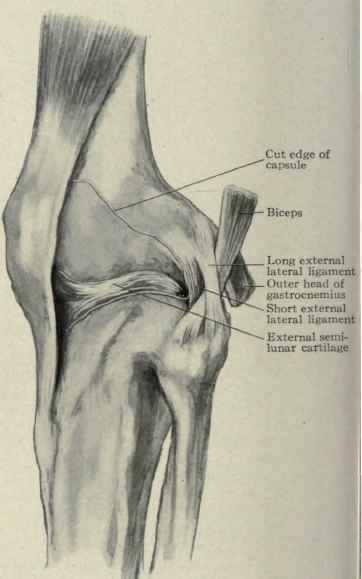 Fig. 547.   View of the outer side of the knee joint. The capsule has been cut away from the edge of the patella to the external lateral ligament.