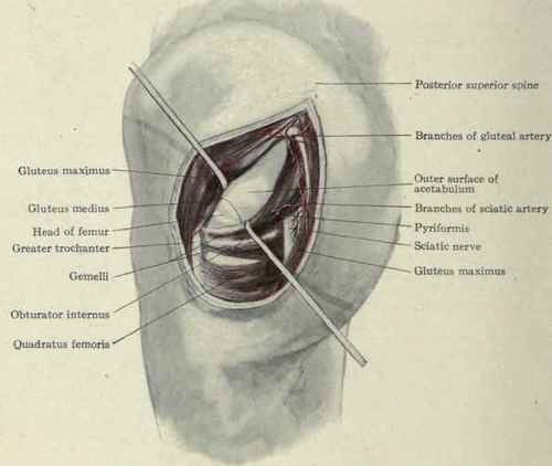 Pig. 527. The lateral mode of approach in operating on the hip joint; large incision made to show relation of the parts involved.
