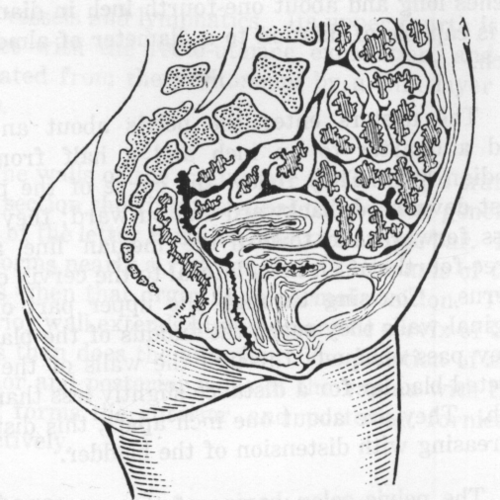 Fig. 4. The Uterus and Its Relation to the Bladder, Rectum and Small Intestines