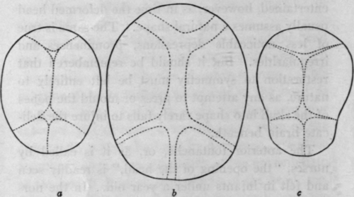 Fig. 1. Diagram Showing Shape of Heads. a, Normal head; b, Hydrocephalic head; c. Rickety head.