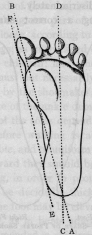 Fig. 13.   Tracing of Normal Foot.