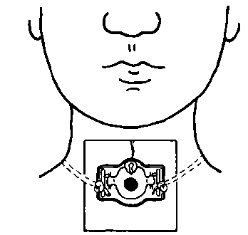 Laryngectomy Dressing