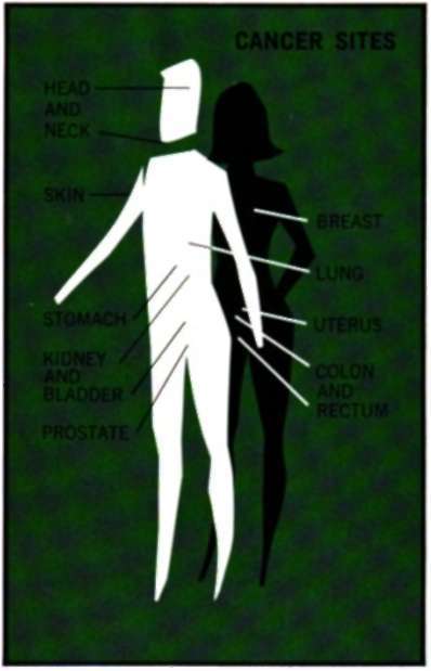 sites of the major forms of solid tumors