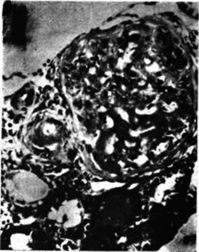 Kidney from a rat treated with desoxycorticosterone acetate