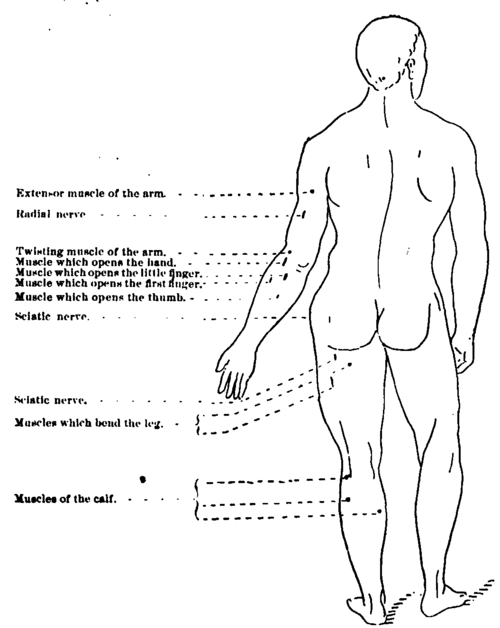 Fig. 319. Showing points at which electricity should be applied to affect special nerves and muscles.