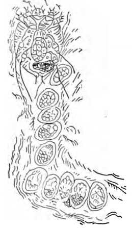 Fig. 339. Female Scabiei Itch Mite Laying Eggs in a Burrow.