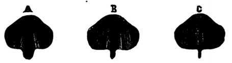 Fig. 297. Healthy Vocal Cords in Different Stages of Respiration.