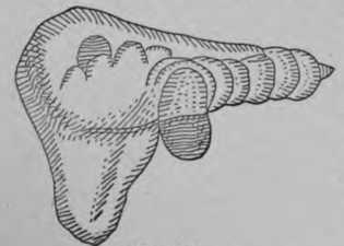 Fig. 291. Liver Distorted by Tight Lacing.