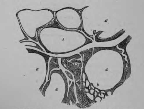Fig. 307. A magnified portion of Lung affected by Emphysema.
