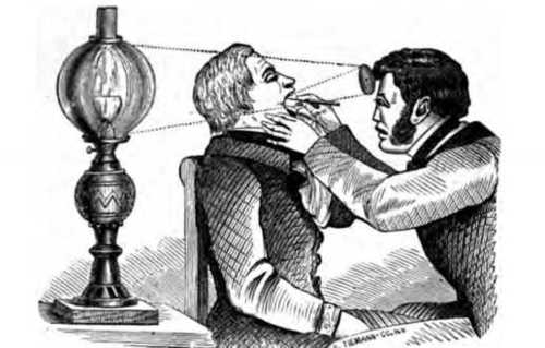 Fig. 296. Using the Laryngoscope.