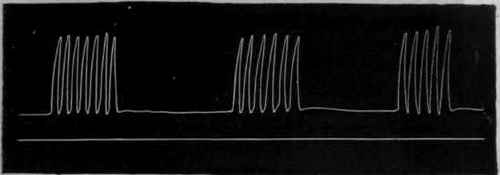 Fig. 104.   Periodic rhythm of the heart, the pulsations occurring in groups separated by intervals of complete quiescence.