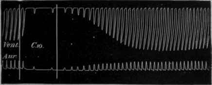 Fig 113