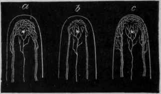 Fig. 121.__Diagram to show the effects of heat and cold in lessening the pain of inflammation. The