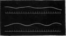 Fig. 133.   Shows the effect of anaemia. The upper tracing shows the movements of the intestine supplied with normal blood; the lower shows the movements of an intestine rendered more vigorous by anaemia.