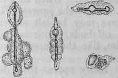 Fig. 20.   Different stages of the changes undergone by spores through the action of phagocytes