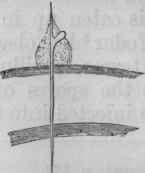 Fig. 21.   A germinating spore with leucocyte adherent to it