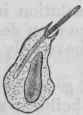 Fig. 27.   Leucocyte of a frog from the neighbourhood of a piece of the lung of a mouse infected with anthrax about forty two hours after the piece of lung had been placed under the skin of the frog's back.