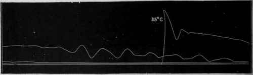 Fig. 50.   Tracing of the contraction curve of a muscle poisoned by veratrine and exposed to a high temperature. The poison tends to cause prolonged contraction, and the high temperature to cause rapid relaxation of the muscle.
