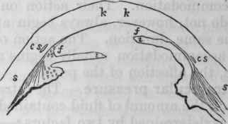 Fig. 75.   This diagram (which I owe to the kindness of Mr. J. Tweedy) represents a section through the corneo scleral region, ciliary body and iris, of a healthy eye (left side), and of a glaucomatous eye (right side) : k, cornea; s, sclerotica; i, iris; /, spaces of Fontana; c s, canal of Schlemm.