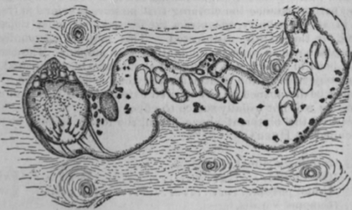 Fig. 29.   Cuniculus, with acarus, eggs, etc. (Furstenberg.)