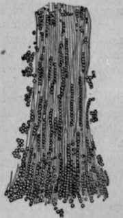 Fig. 31. Portion of a hair infiltrated with the spores of the trichophyton tonsurans.