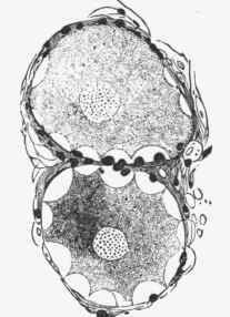 Cells from the sympathetic ganglion of a cat. The protoplasm is retracted here and there from the cell wall.