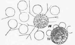 Microscopic appearance of the blood after the addition of distilled water.