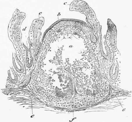 Section of Single Lymph follicle of the Small Intestine.