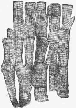 Striated Muscle Tissue of the Heart, showing the trelliswork formed by the short branching cells, with central nuclei.