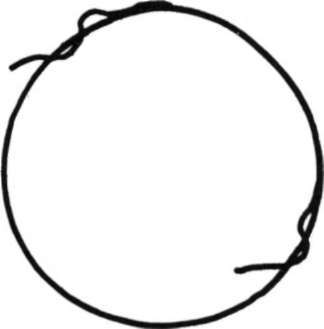 Galvanized neutralizing hoop
