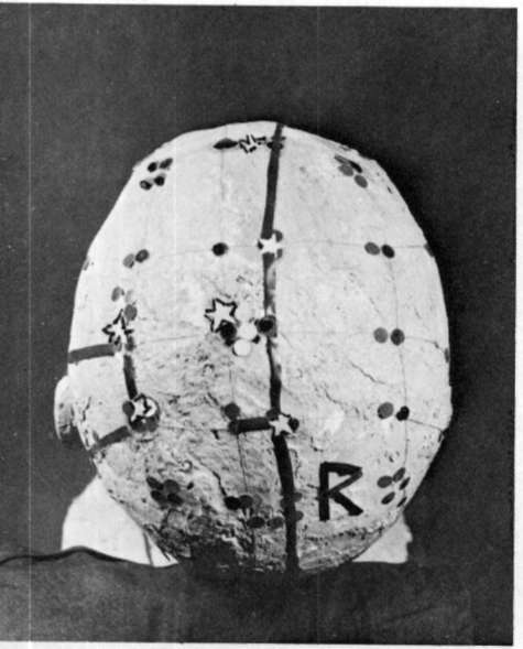 Symbols On Apollo's Head