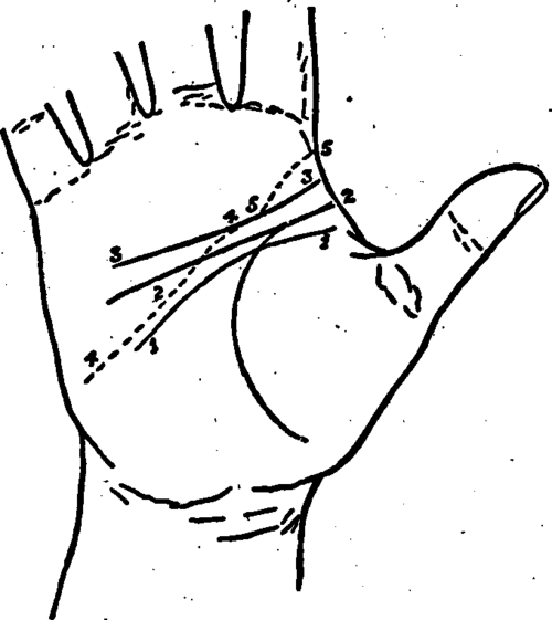 Plate 1. The Three Principal Positions For The Commencement Of The Line Of Head.