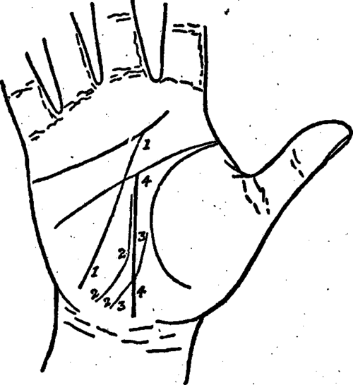 Plate XII. The Link Of Destiny And Its Variations.