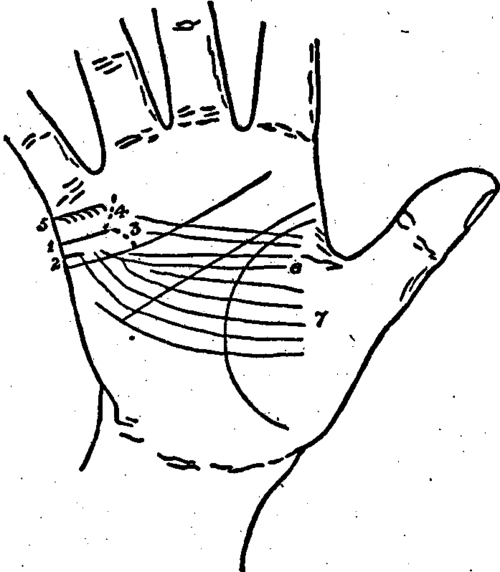 Plate XVII. Marriage Lines. The Linb Of Marriage.
