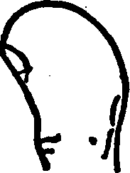 The Clubbed Thumb.