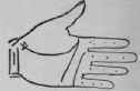 3 Malformation 517