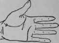 3 Malformation 519