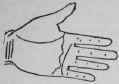 3 Malformation 522