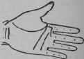 A Line Cutting The Root Of The Second Finger 337