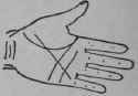 A Line Cutting The Root Of The Second Finger 342
